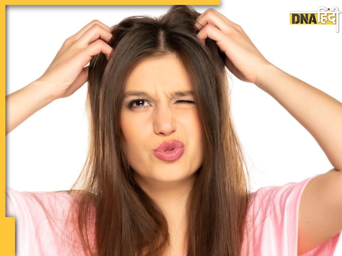 Scalp Itching Relief Tips: सिर में खुजली से हैं परेशान तो अपनाएं ये 3 घरेलू नुस्��खें, दूर हो जाएगी पुरानी से पुरानी समस्या