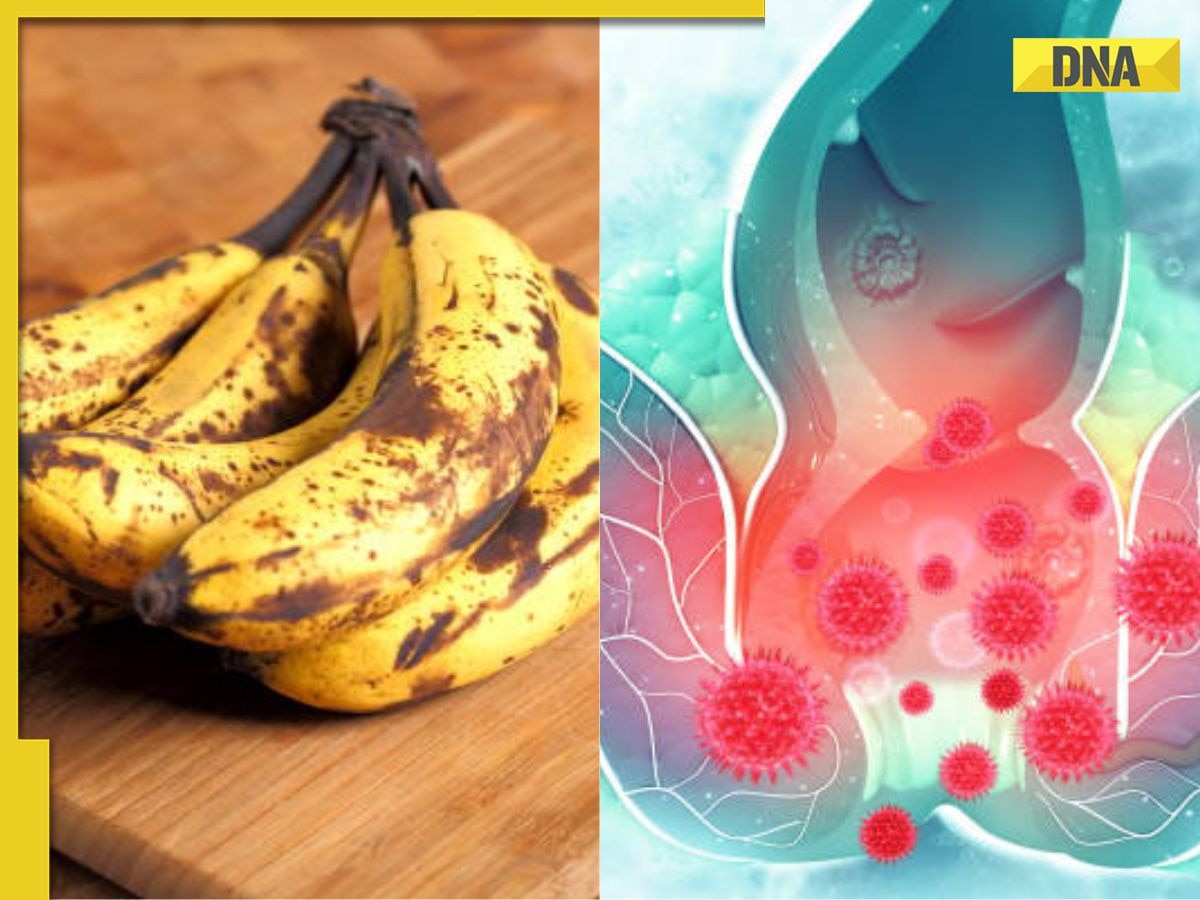 Banana for piles Know how and when to consume banana as per Ayurveda
