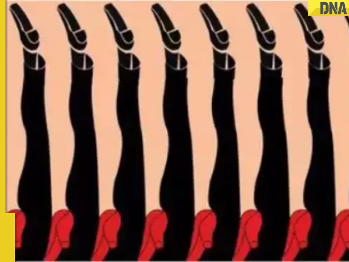 Optical illusion: How many legs you can see in this pic