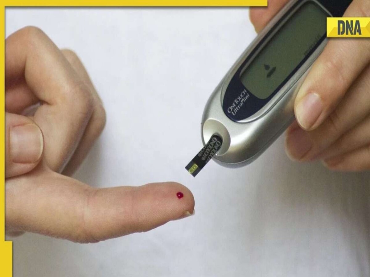 Diabetes How high sugar levels can cause skin problems? Know these