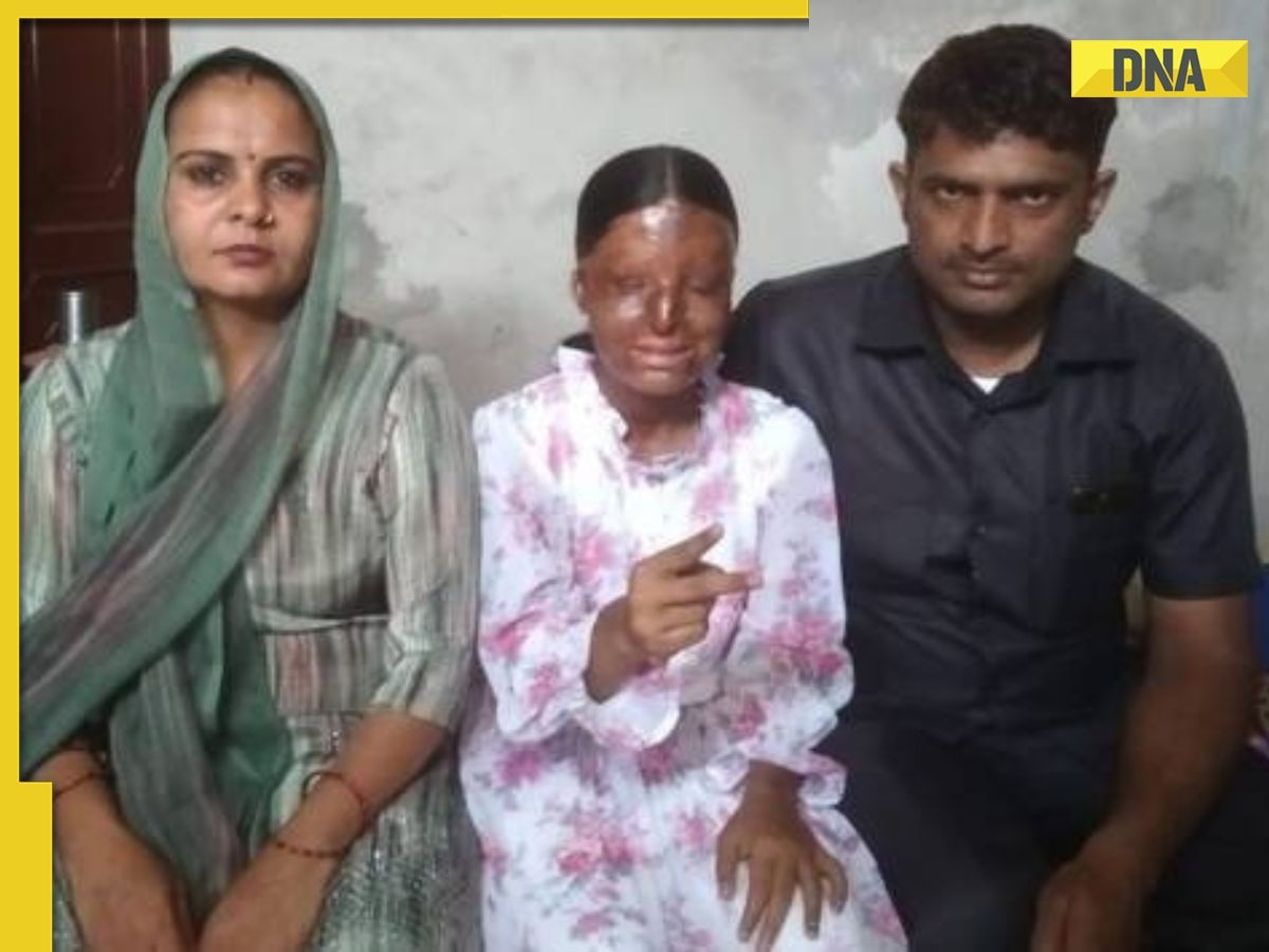 Meet Kafi, an acid attack survivor who scores 95% in CBSE class 10 exams despite the challenges