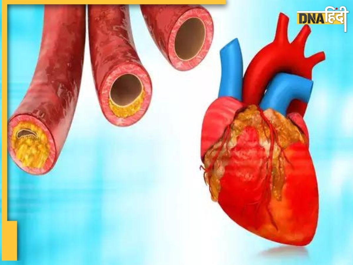 Cholesterol Remedy: धमनियों की दीवारों पर चिपके गंदे वसा पिघला देंगे ये 6 जूस, बिना दवा ही कम हो जाएगा हाई कोलेस्ट्रॉल 