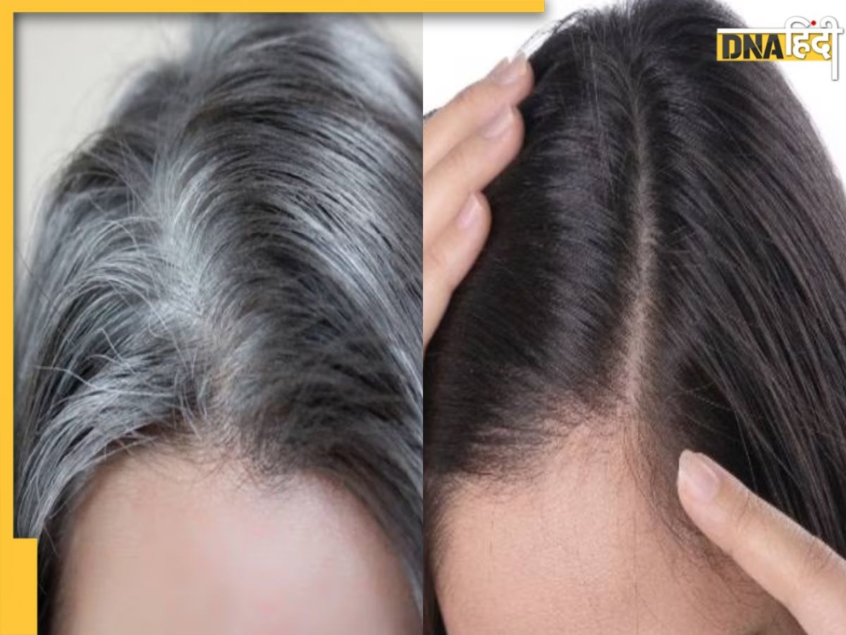 White Hair Remedy: सफेद बालों को हमेशा के लिए काला कर देंगे दादी-नानी के बताए ये नुस्खें, आज स�े ही करें इस्तेमाल