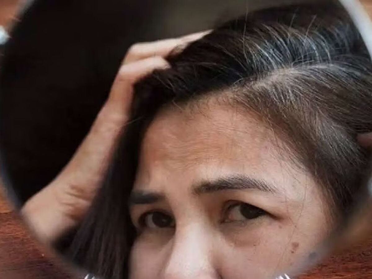 White Hair Remedy:20 की उम्र में ही इस विटामिन की कमी से सफेद हो जाते हैं बाल, 3 नुस्खें आजमाएं हो जाएंगे Black Hair