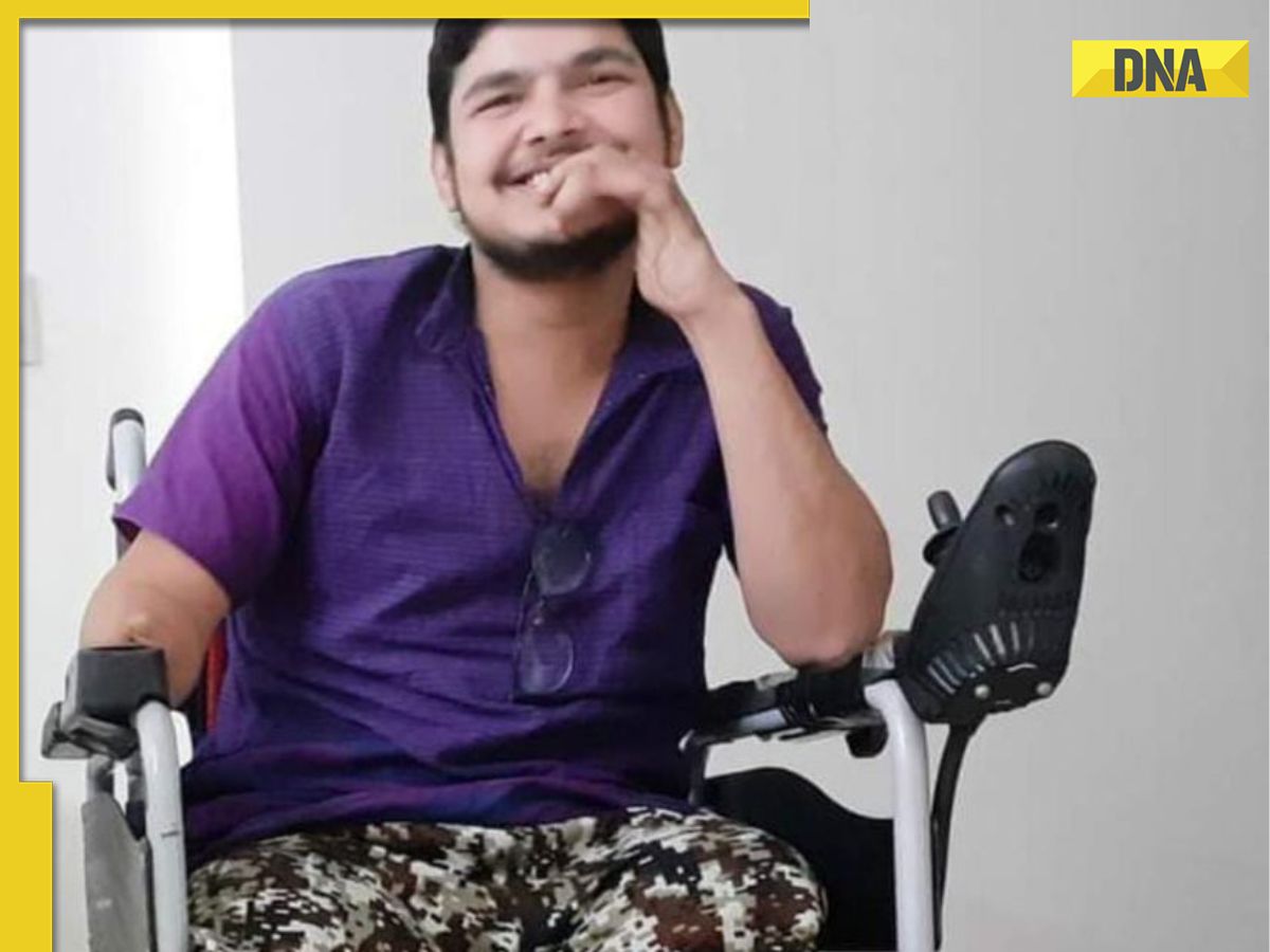 Meet Suraj Tiwari, Man Who Lost Both Legs, Right Arm In Accident Clears ...