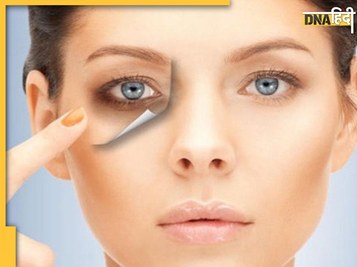 Dark Circles Removing Tips: आ��ंखों के नीचे काले घेरों से हैं परेशान तो अपनाएं ये देसी नुस्खे, हमेशा के लिए खत्म हो जाएंगे डार्क सर्कल्स