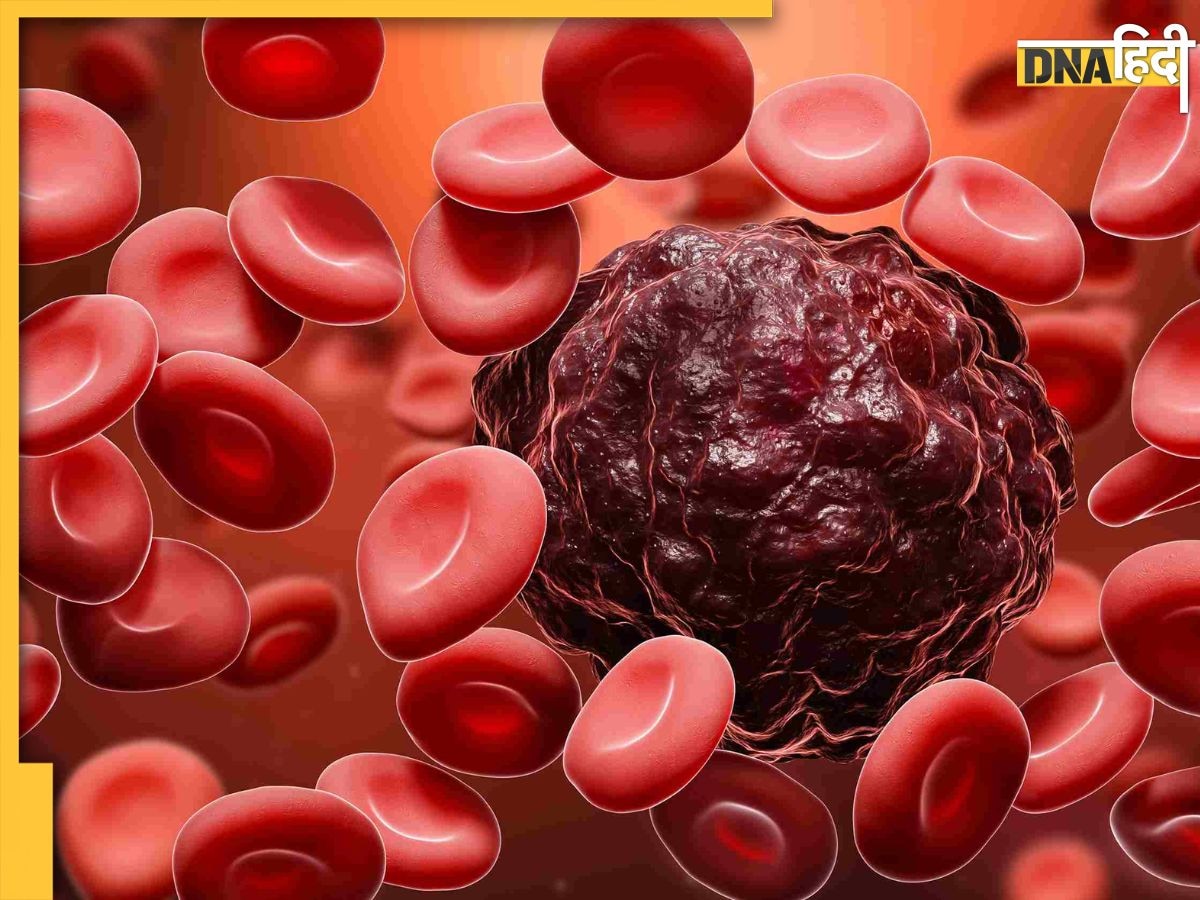 Blood Cancer Signs: शरीर में दिखने वाले इन लक्षणों को भूलकर भी न करें नजरअंदाज, हो सक�ते हैं ब्लड कैंसर का संकेत