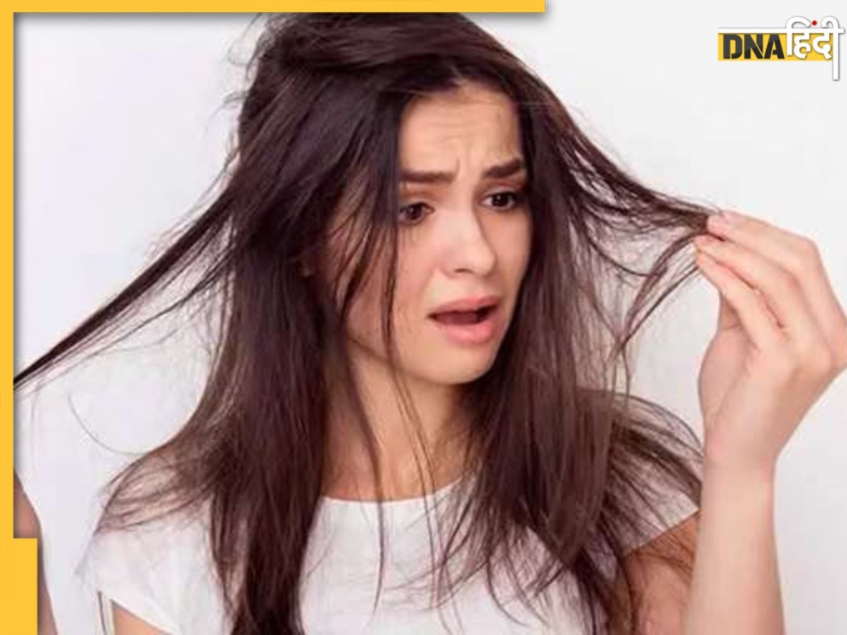 Dry Hair से हैं परेशान? बालों में इन चीजों के साथ मिलाकर लगाएं दही, हफ्ते भर में दिखने लगेंगे शायनी और सॉफ��्ट 