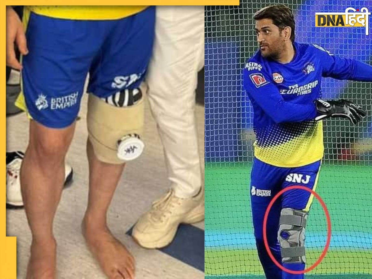 Dhoni Knee Surgery: धोनी के बाएं घुटने का हुआ ऑपरेशन, अब IPL 2024 में खेल पाएंगे या नहीं, इस पर सामने आई ये बात