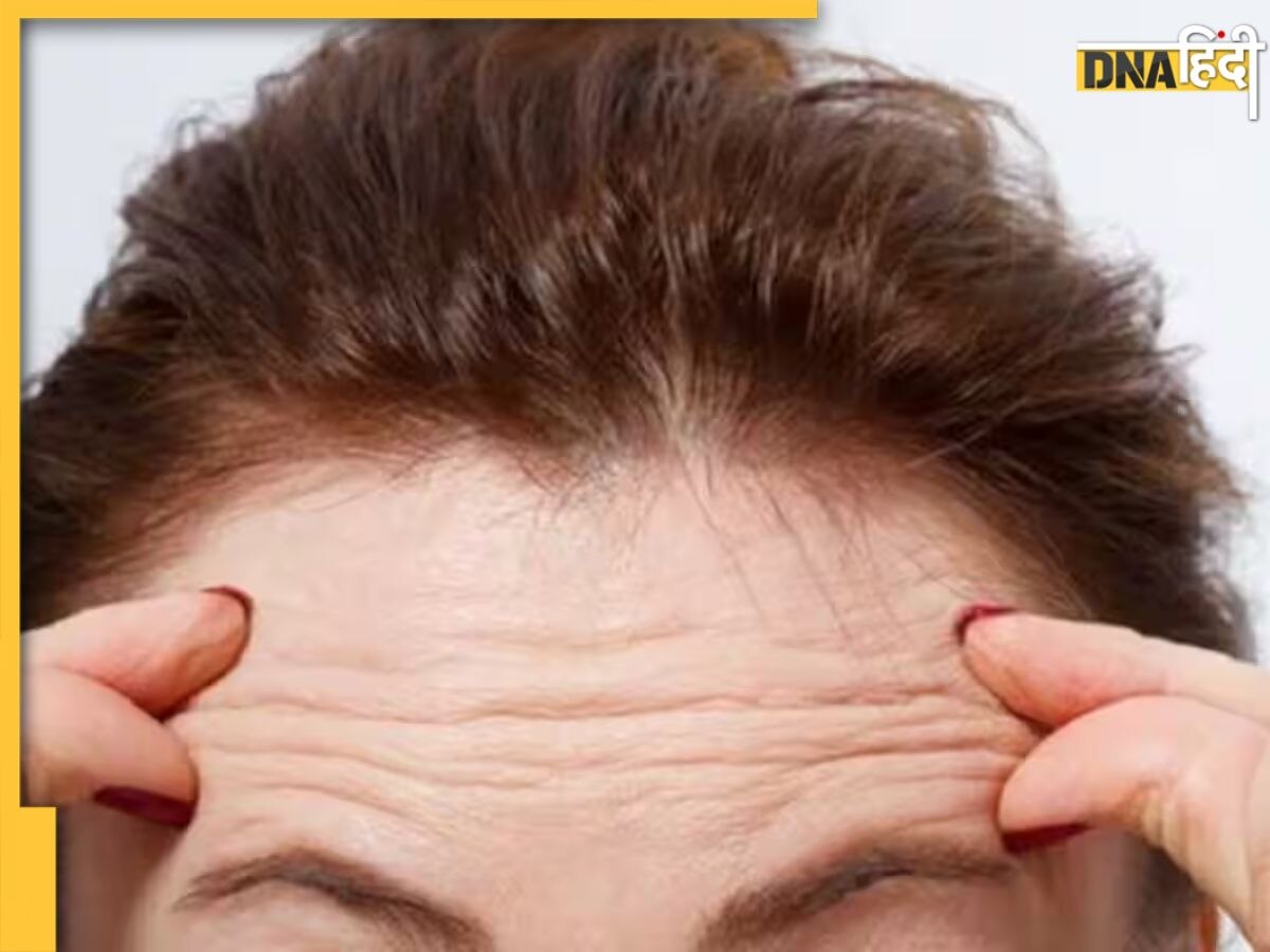 Wrinkle Removing Tips: झुर्रियों के कारण दिखने लगे हैं बूढ़े तो जवां स्किन के लिए फॉलो करें ये आसान टिप्स, दिखने लगेगा असर