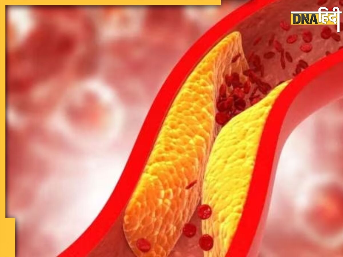 Cholesterol Home Remedy: किचन में मौजूद पीले और काले मसाले का जोड़ खोल देगा बंद नसें, खत्म हो जाएगा Bad Cholesterol