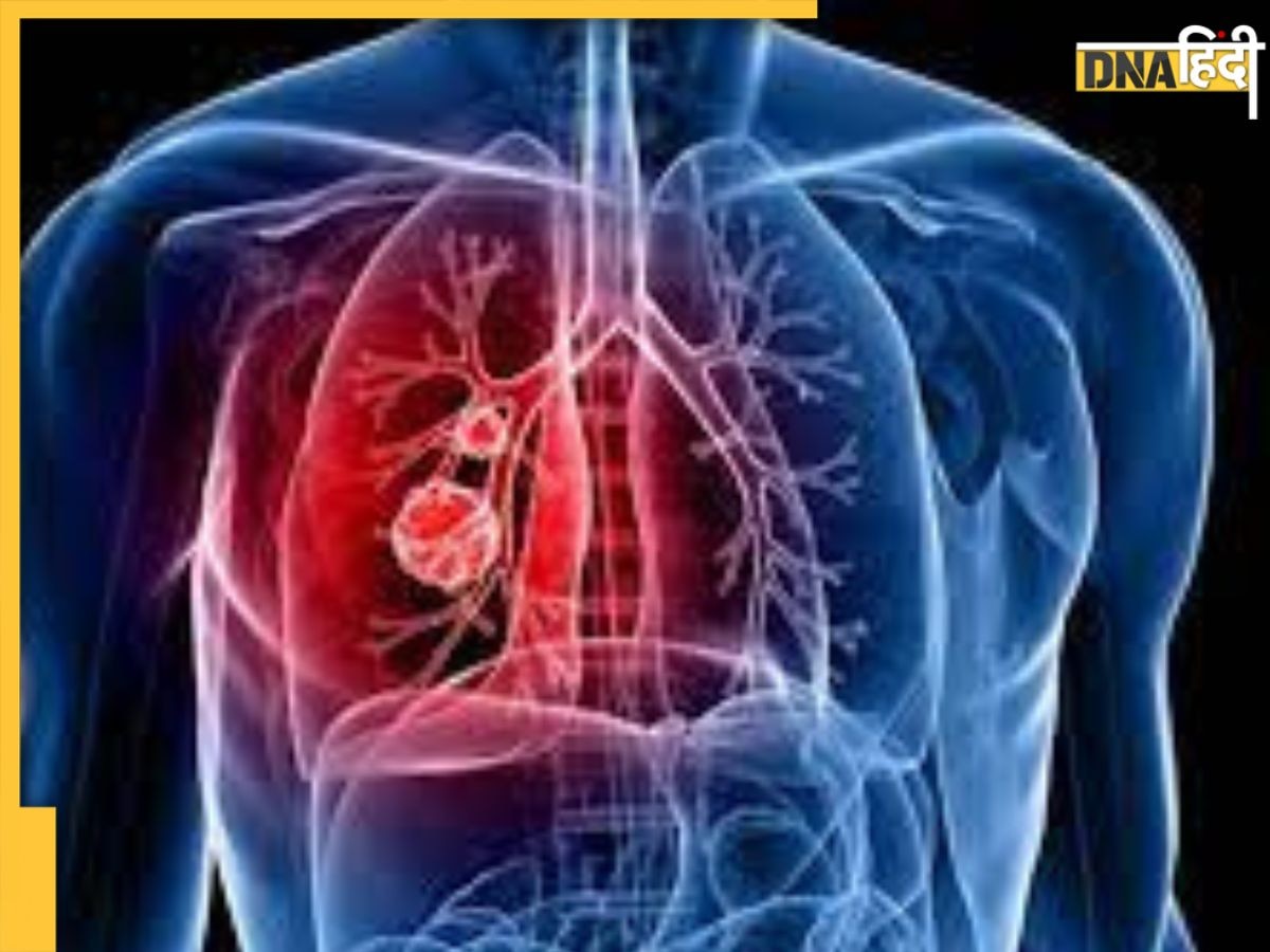 Lungs Cleaning Foods: फेफड़ों का कचरा निकाल देंगी ये 5 सस्ती चीजें, छनकर आएगी हर सांस