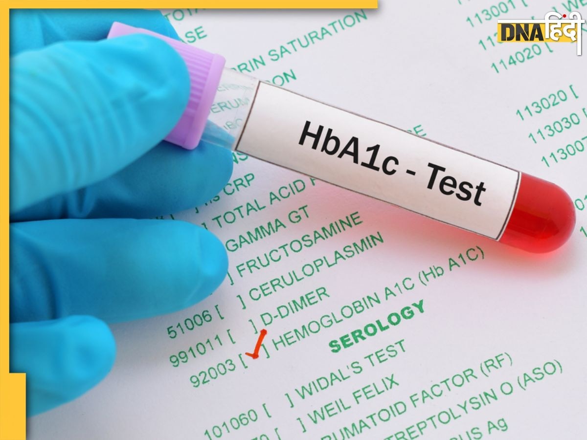 Diabetes Test: डायबिटीज मरीजों को हर 3 महीने में जरूर कराना चाहिए ये टेस्ट, लापरवाही बढ़ा सकती है खतरा  