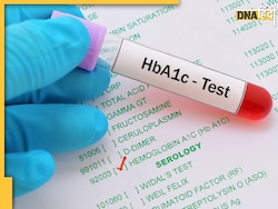 Diabetes Test: डायबिटीज मरीजों को हर 3 महीने में जरूर कराना चाहिए ये टेस��्ट, लापरवाही बढ़ा सकती है खतरा  