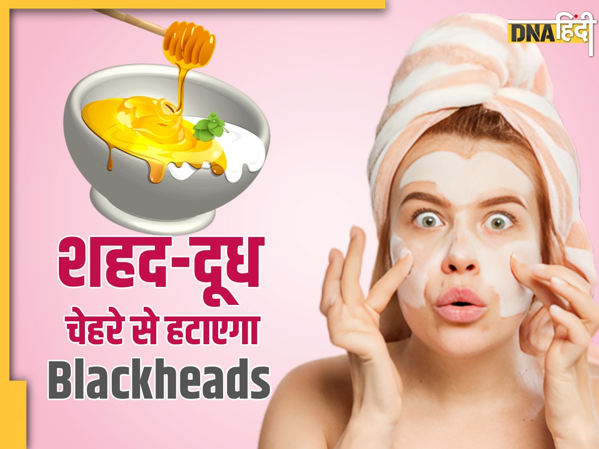 Blackheads Removal Remedies: शहद और दूध के इस नुस्खे से चेहरे से मिनटों में गायब होंगे ब्लैकहेड्स, ऐसे करें यूज