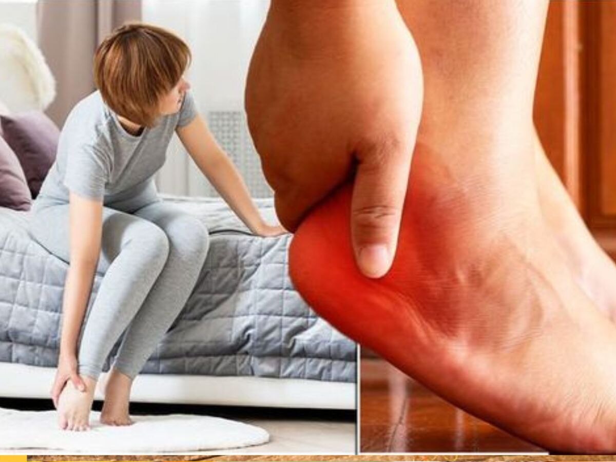 Gout Risk Factor: इन 5 वजहों से जोड़ों में जमता है यूरिक एसिड का क्रिस्टल, खराब हो जाती है किडनी