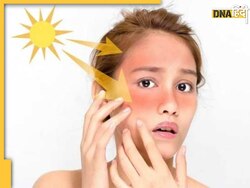 Tanning Removal Home Remedies: चिलचिलाती धूप से जल गई है स्किन तो चेहरे पर भून कर लगाएं हल्दी, चुटकियों में दूर हो जाएगी टैनिंग 
