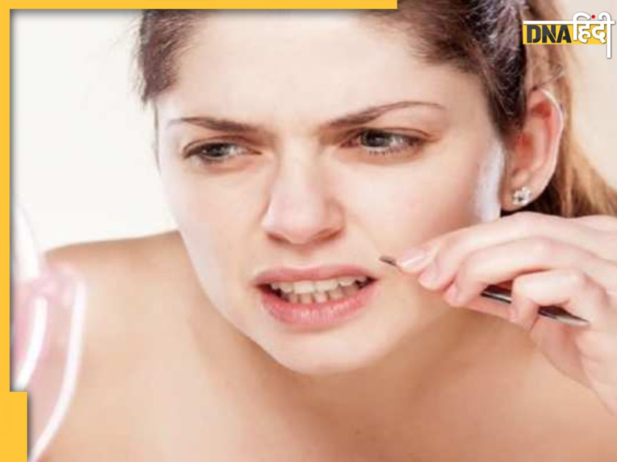 Home Remedies For Facial Hair इन 'होममेड हेयर रिमूवल' से मिनटों में