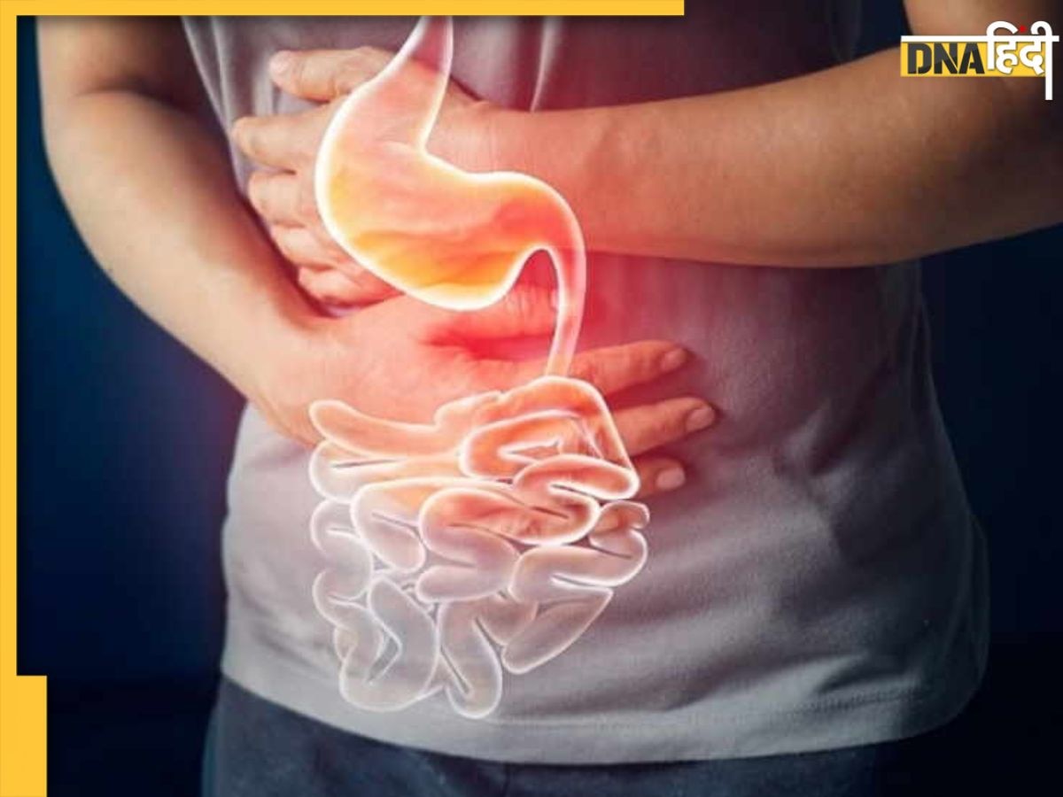 Worst Foods for Gut Health: आंतों के लिए जहर हैं ये 5 फूड, नहीं छोड़ेंगे खाना तो लगाने पड़ जाएंगे अस्पताल के चक्कर