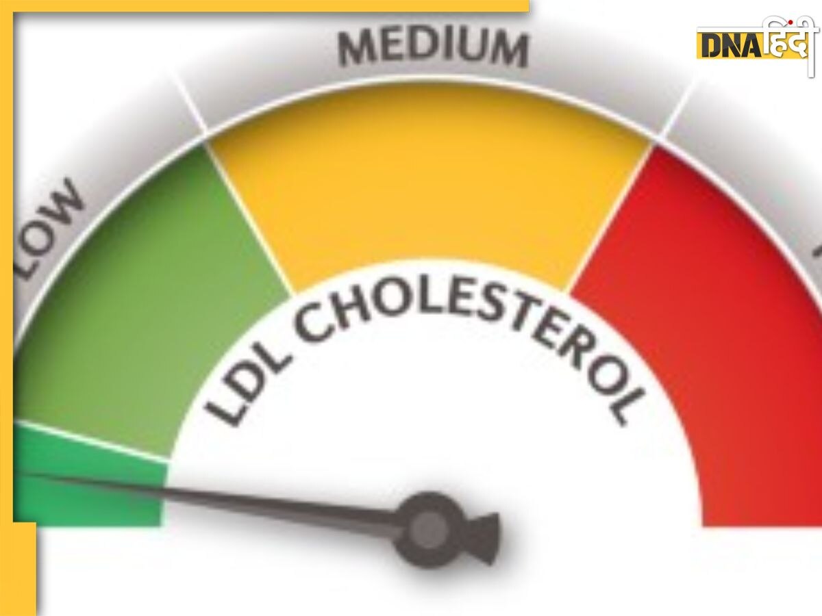 Superfoods For Bad Cholesterol: नसों में जमा बैड कोलेस्ट्राॅल को सूखा देंगे ये 10 सुपरफूड्स, बंद धमनियों में भी दौड़ने लगेगा खून