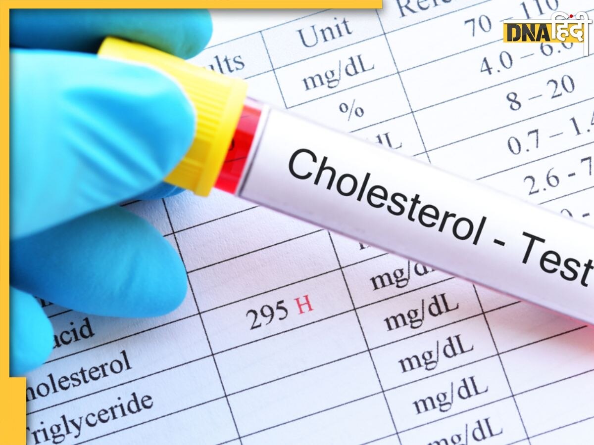 Cholesterol Test: ये टेस्ट खोल देगा नसों में जमा बैड कोलेस्ट्राॅल का राज, हार्ट अटैक से बचने के लिए जरूर कराएं चेक