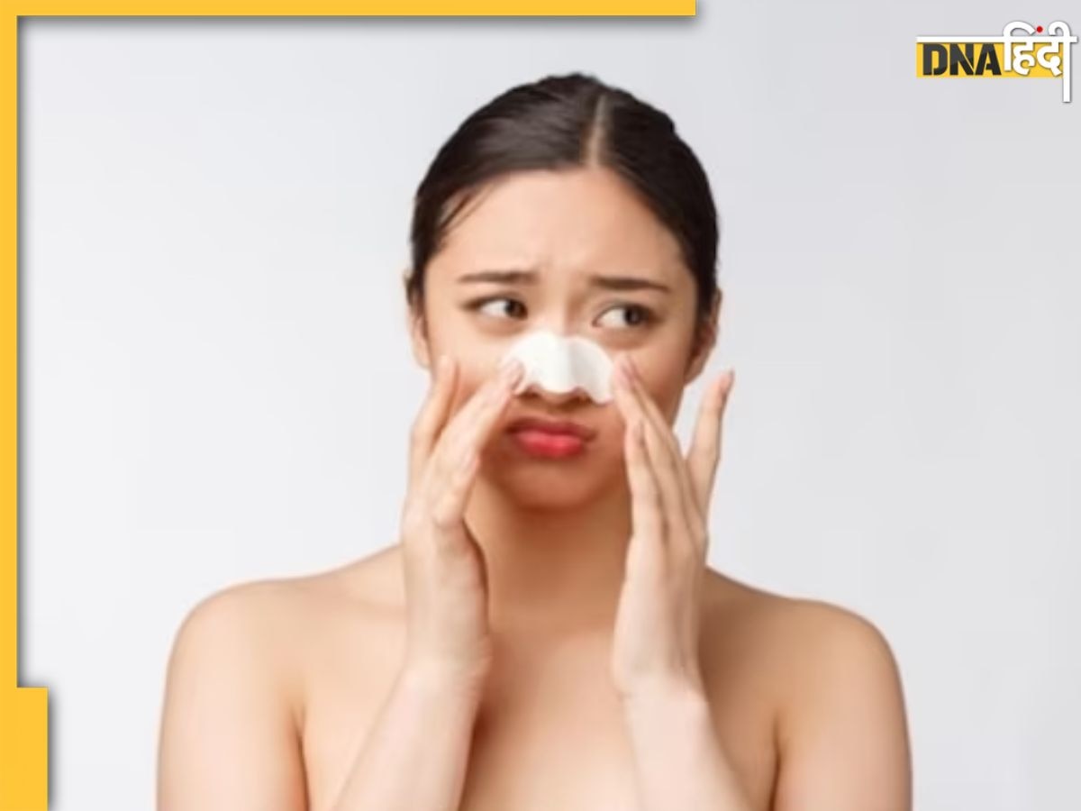 Blackheads Remover Tips: चेहरे की खूबसूरती छीन रहे हैं वाइट और ब्लैक हेड्स तो अपनाएं ये आसान उपाय, जड़ से खत्म होंगे काले धब्बे 