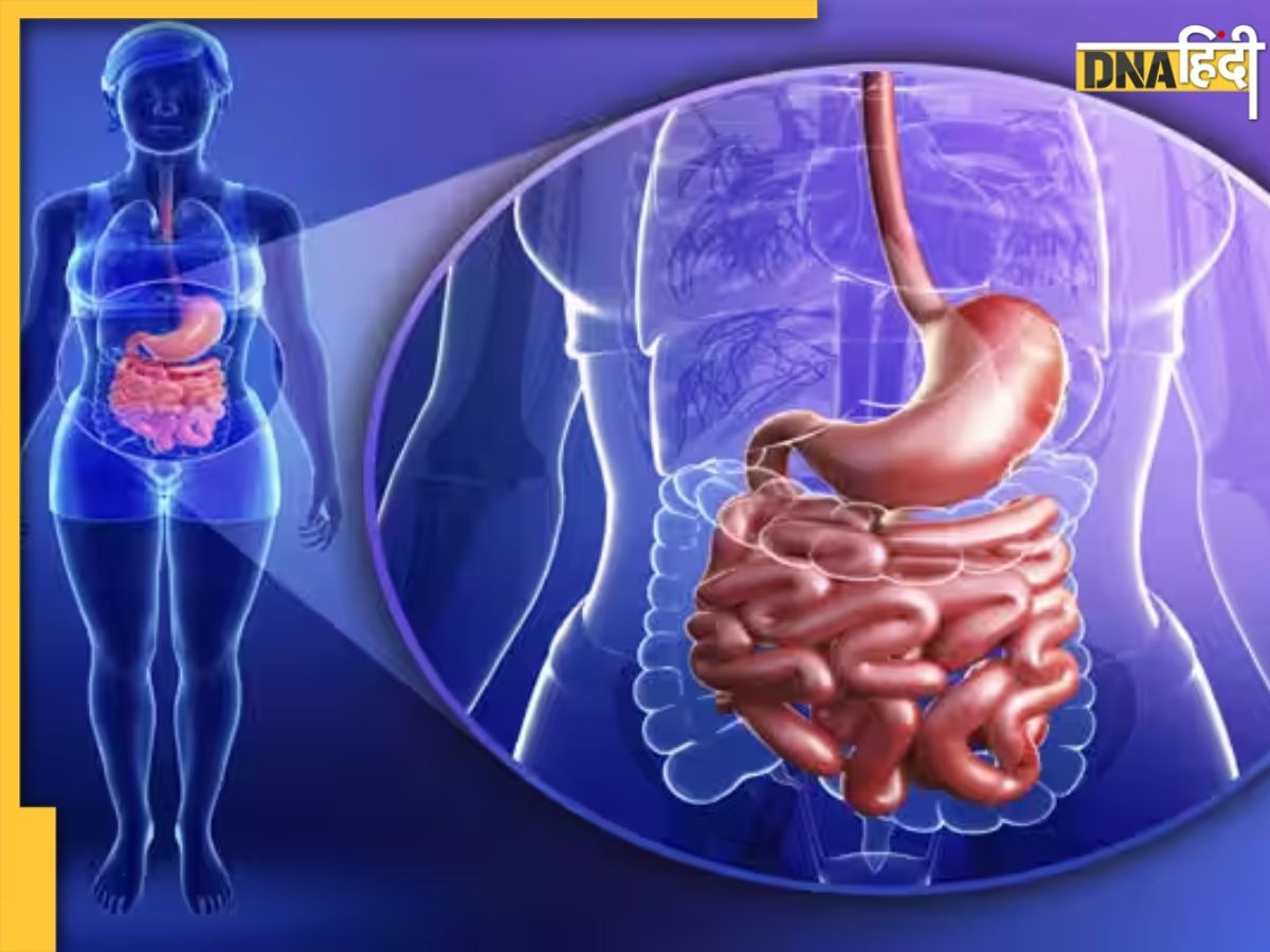 Stomach Worms Symptoms: ये 5 लक्षण बताते हैं पेट में पड़ गए हैं कीड़े, इन चीजों के सेवन से हो जाएंगे खत्म