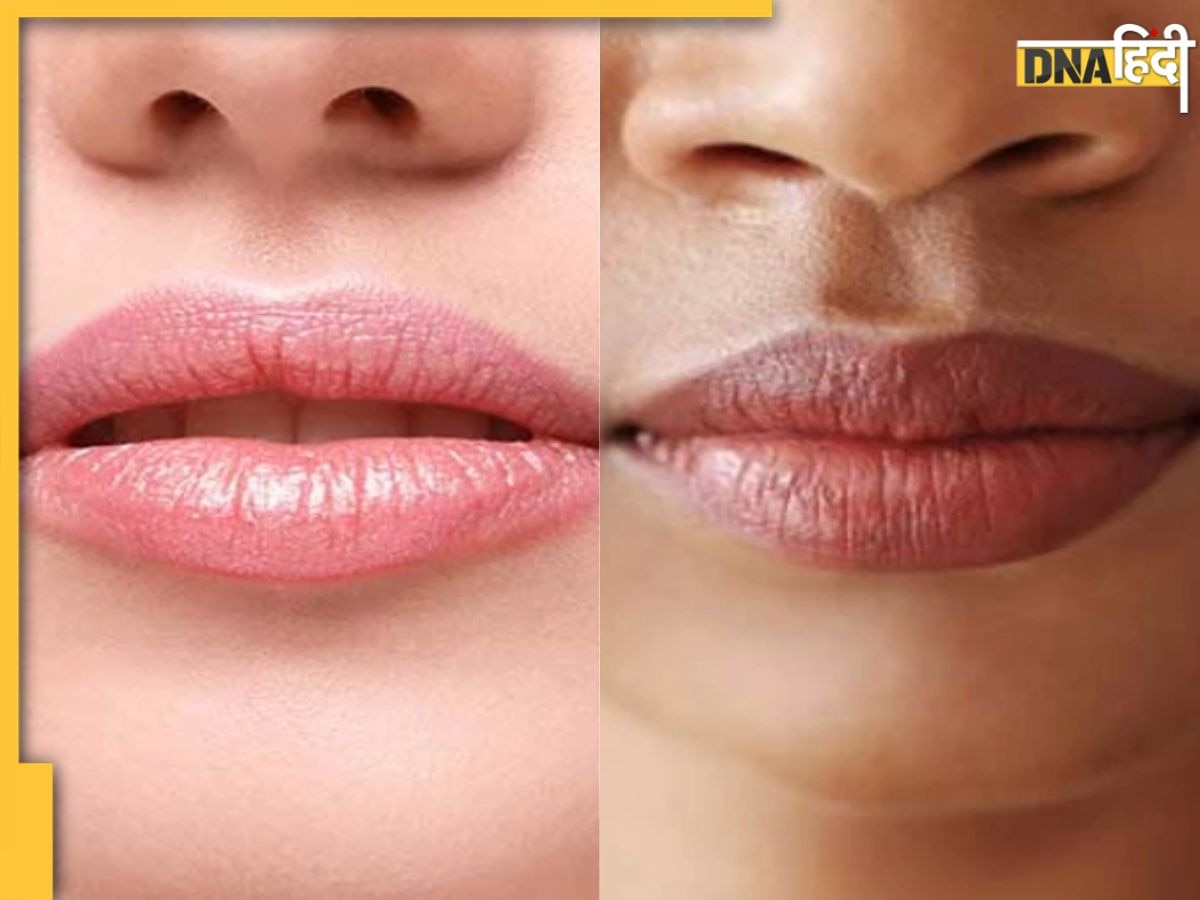 Dry Lips Causes: स्मोकिंग ही नहीं, होंठ काले होने के पीछे हैं ये 4 बड़ी वजह, न बरतें लापरवाही