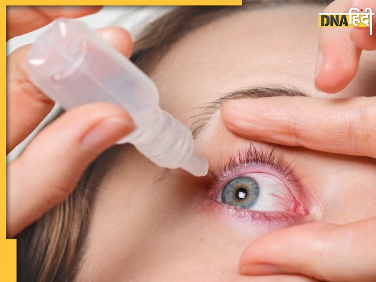 Home Remedy For Eye Flu: अगर आपको भी हुआ है Eye Flu तो घर पर ऐसे करें ठीक, जल्द मिलेगी राहत