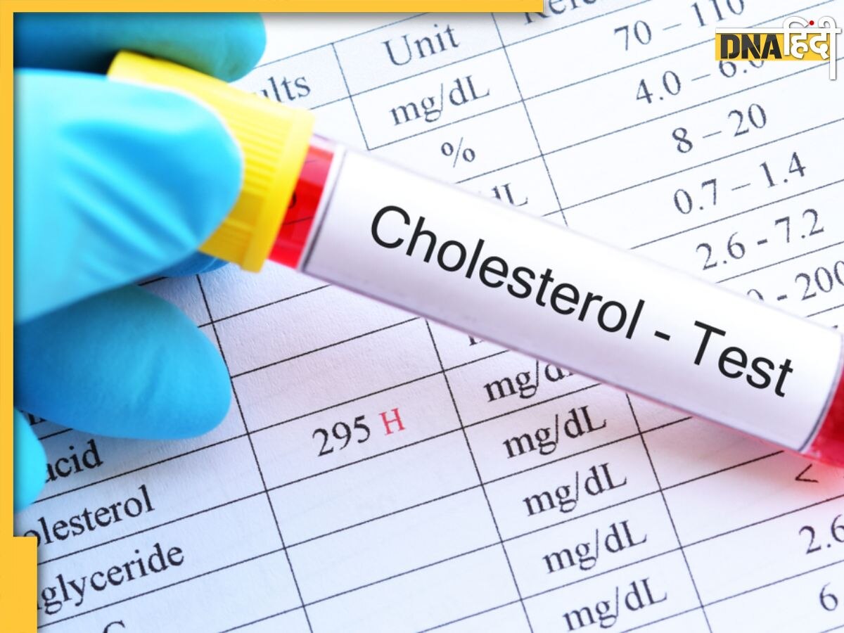 Cholesterol Test: ये 4 लोग ��जरूर करा लें कोलेस्ट्रॉल टेस्ट, अनदेखी करने पर आ सकता है हार्ट अटैक