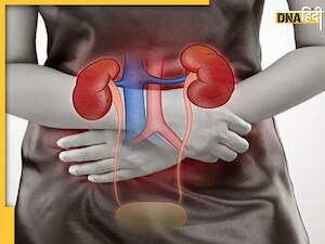 Foods Damage Kidney Filter: ये 6 फूड्स किडनी फिल्टर कर देंगे खराब, शरीर और खून की गंदगी नहीं होगी साफ