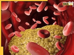 Cholesterol Remedy: नसों में जमा गंदा कोलेस्ट्रॉल छानकर बाहर निकाल देंगी य�े 3 पत्तियां, नहीं बढ़ेगा शुगर 