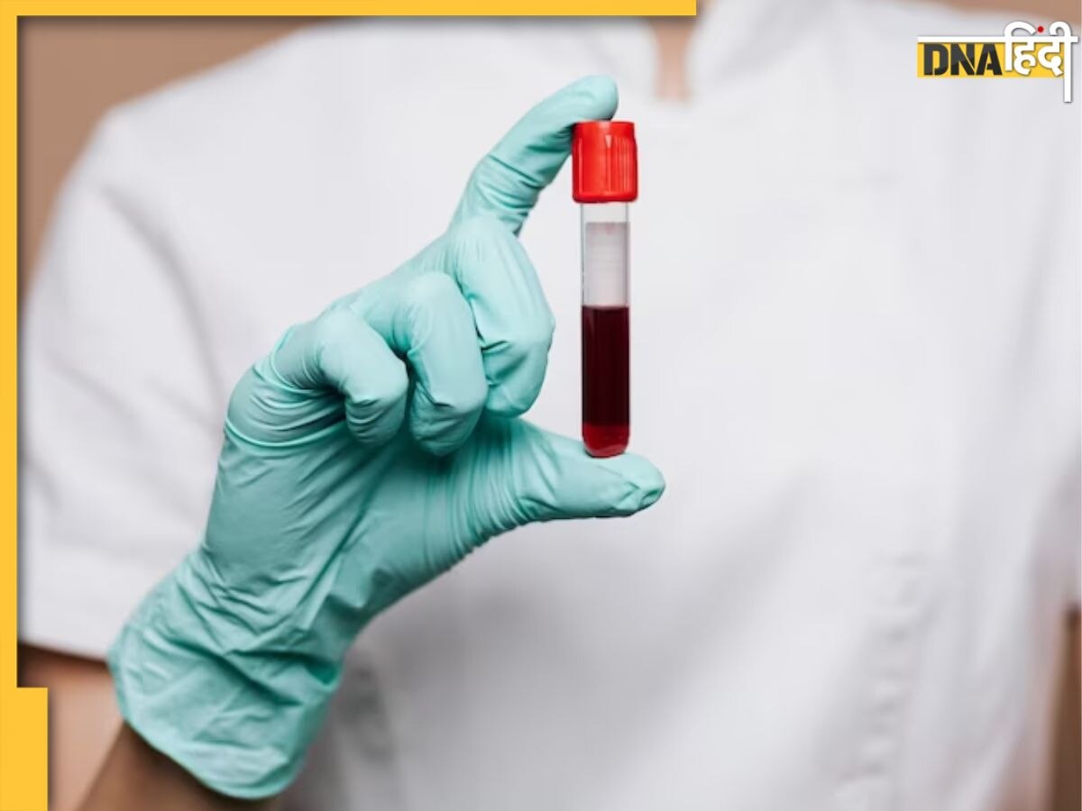 Blood Group Types Disease: इस ब्लड ग्रुप के लोगों को होता है हार्ट-अटैक का ज्यादा ख��तरा, इन्हें रहता है स्ट्रेस