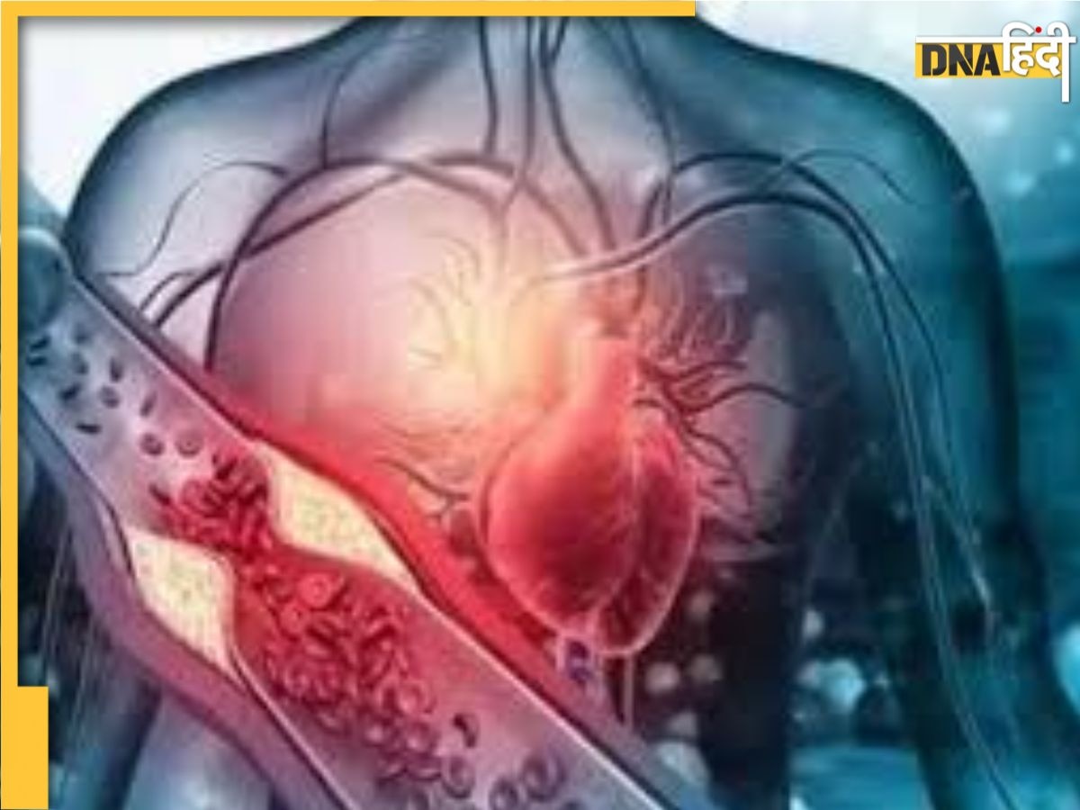 Cholesterol Reduce Tips: नसों में जमा गंदगी की परत को तोड़कर बाहर कर देंगे ये 8 काम, फ्लश आउट हो जाएगा बैड कोलेस्ट्रॉल