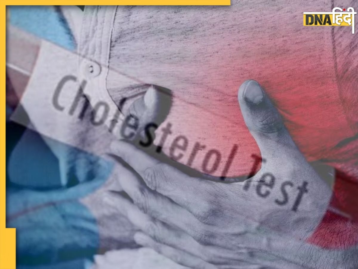 Cholesterol Test: ये टेस्ट बताएगा नसों में भर चुका है गंदा कोलेस्ट्रॉल, हार्ट अटैक का टल जाएगा खतरा