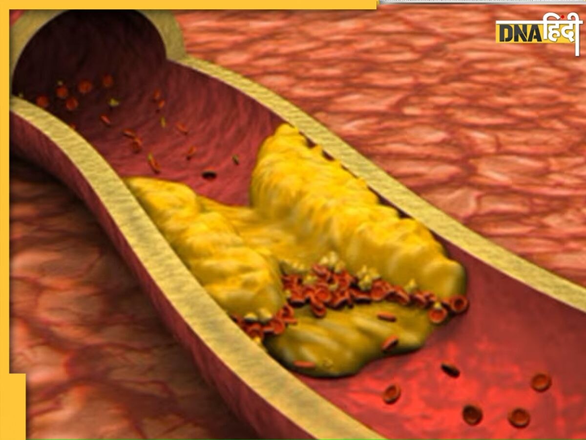 Good Cholesterol: आपके ब्लड में कितना गुड कोलेस्ट्रॉल होना चाहिए?