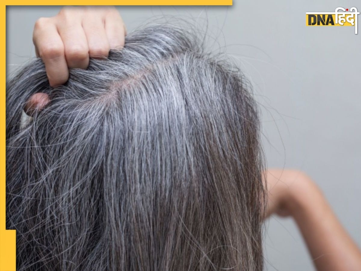 White Hair Prevention: कम उम्र में सफेद होने लगे हैं बाल तो डाइट में शामिल करें ये 10 फूड्स, मिलेग भरपूर पोषण