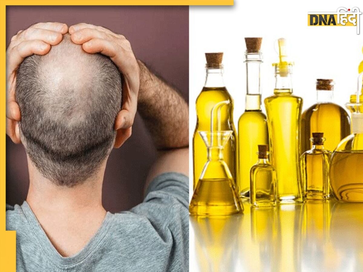 Hair Oil For Baldness: टूटते-झड़ते बालों से नजर आने लगा है गंजापन? ये 5 हेयर ऑयल लगाते ही दूर होगी समस्या  