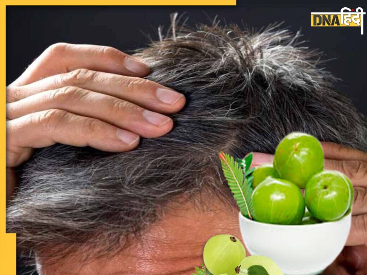 White Hair Remedy: बालों की सफेदी को दूर करेगा हरा आंवला, नहीं रहेगी मेहंदी लगाने की जरूरत