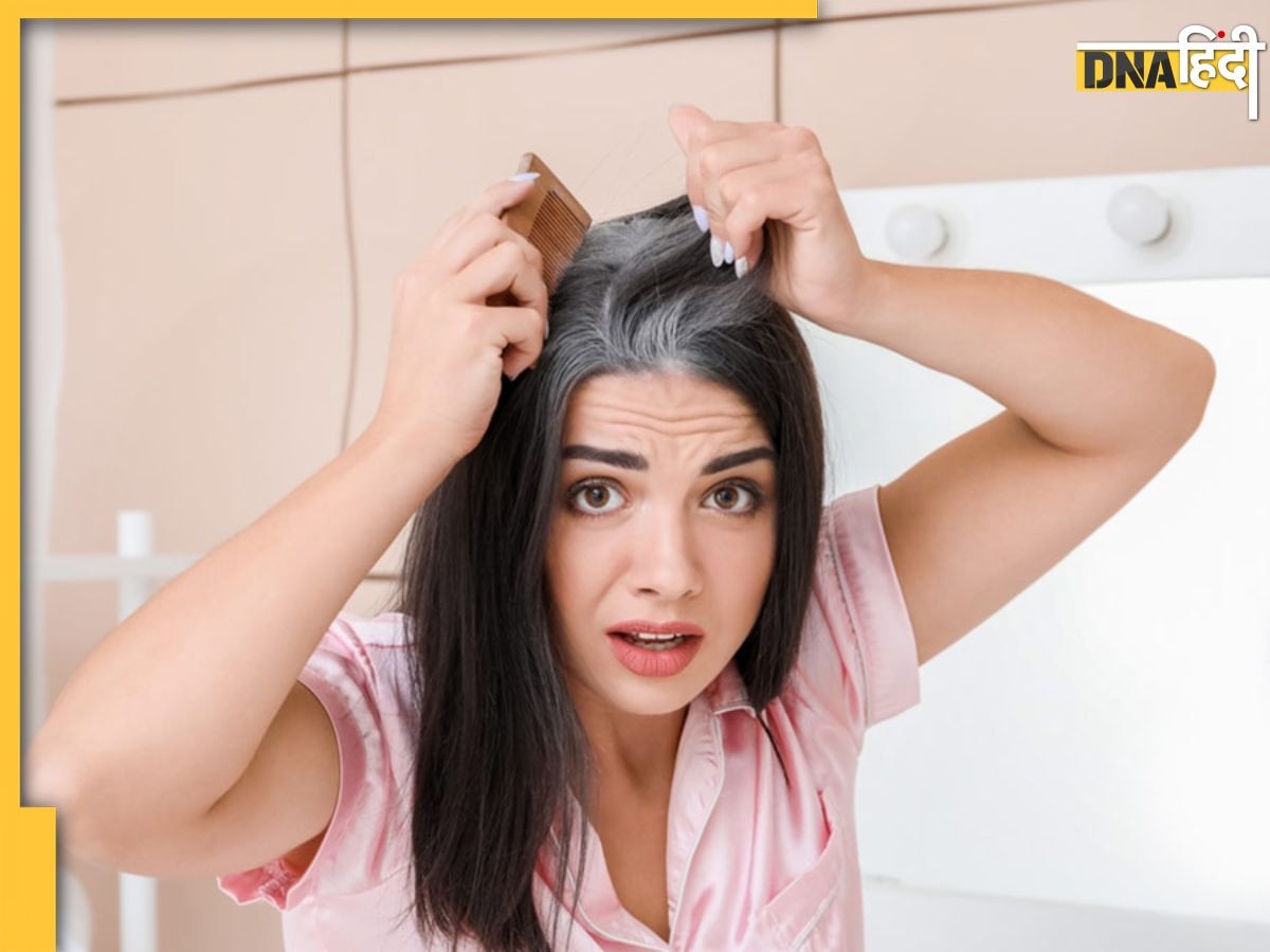 White Hair Remedies: सफेद बालों की छुट्टी कर देगा सरसों के तेल का ये देसी उपाय, जिंदगी भर काले और मज�बूत रहेंगे बाल