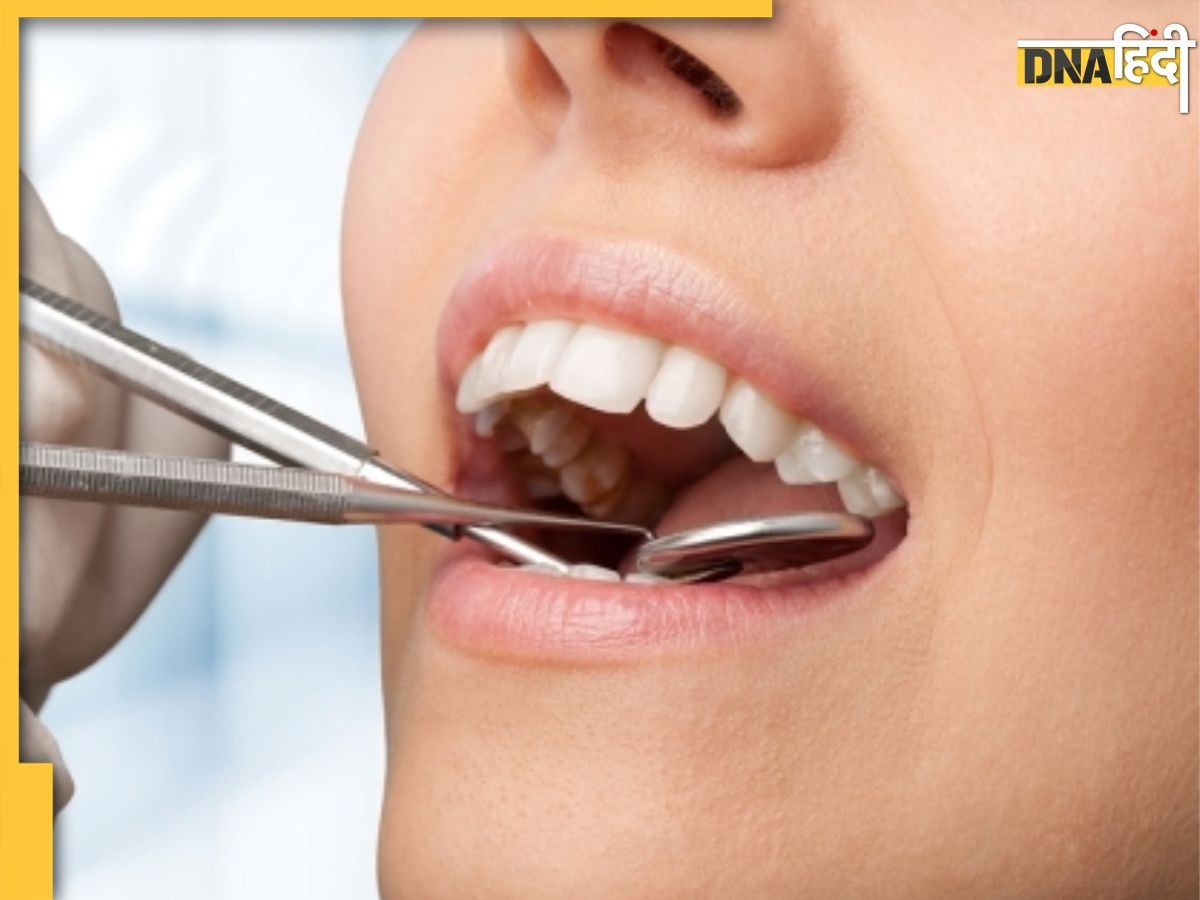 Teeth Cavity Remedies: दांतों में लगे कीड़ों को साफ कर देंगे ये घरेलू नुस्खें, अंदर तक साफ और सफ��ेद हो जाएंगे एक-एक दांत