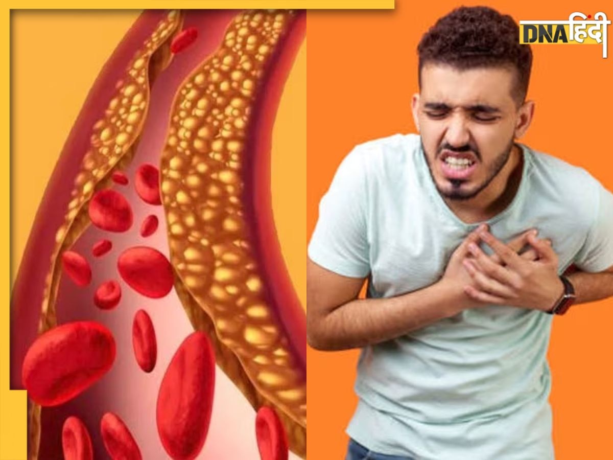 Cholesterol Remedy: नसों में जमा पीली गंदगी बाहर निकाल देंगी ये 5 चीजें, बासी मुंह खाएंगे तो फायदा होगा डबल