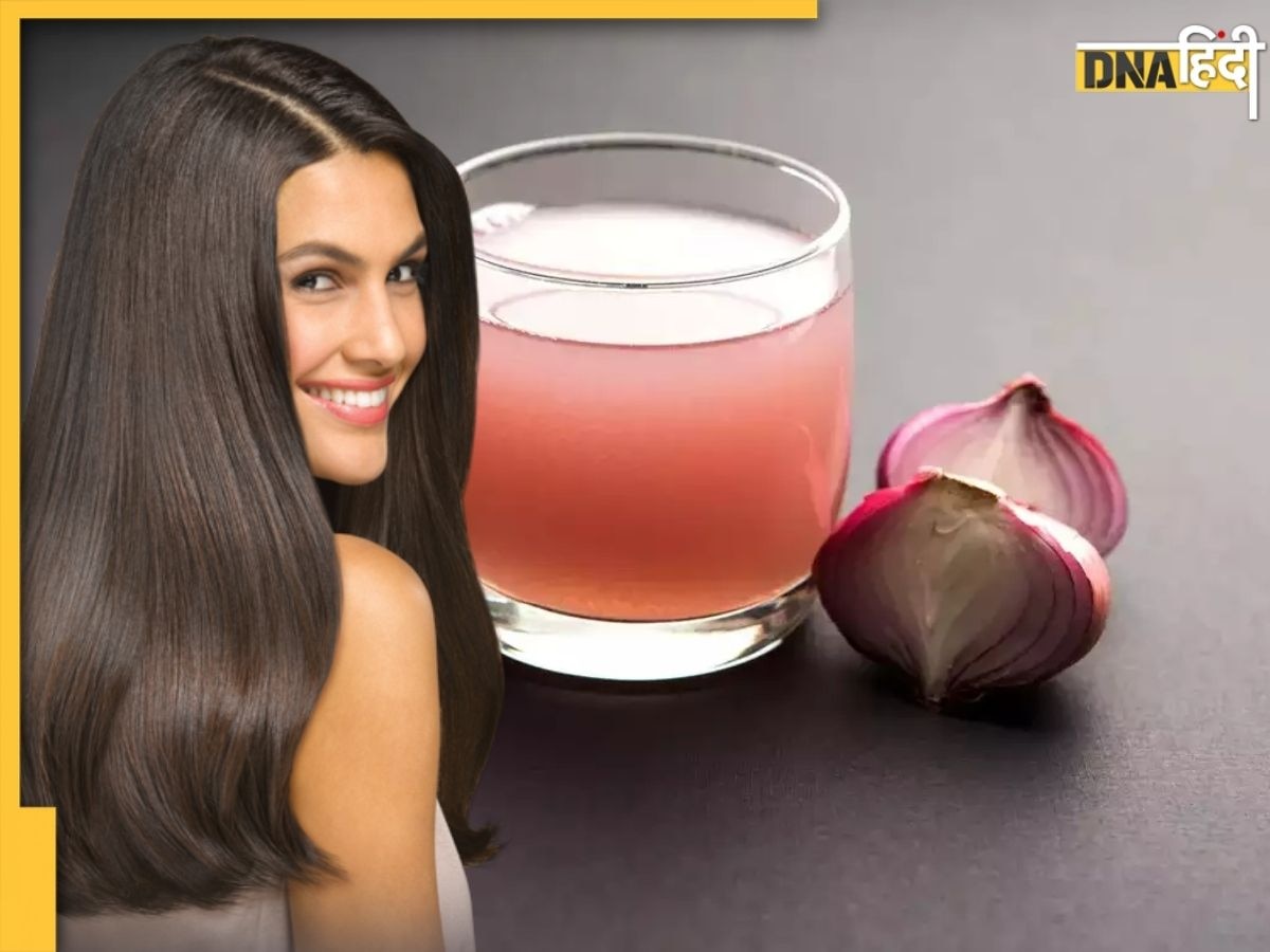 Hair Care Tips: हेयर फॉल रोक देगा इस सब्जी का रस, गंजे सिर पर भी लहराने लगेंगे बाल