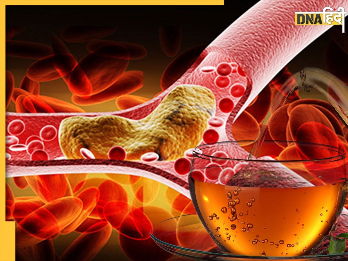 Cholesterol Control: इस पत्ते की चाय से हफ्तेभर में कम होगा गंदा कोलेस्ट्रॉल, खुल जा�एगी नसों की ब्लॉकेज