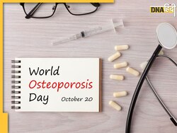 World Osteoporosis Day 2023: हड्डियों की इस बीमारी को खत्म कर देंगी ये 10 चीजें, लोहालाट बन जाएंगी शरीर की एक-एक हड्डी