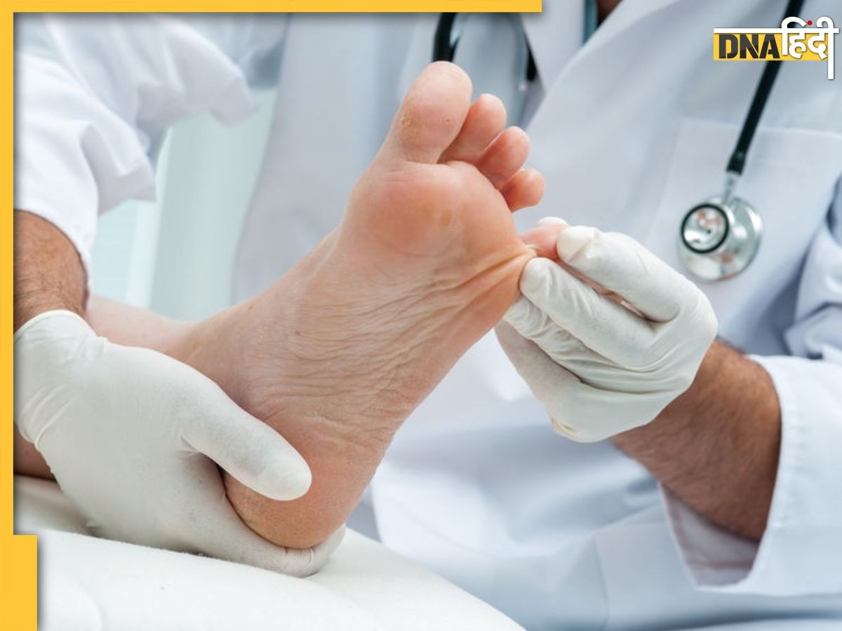 Diabetes Feet Care: सर्दी में डायबिटीज मरीजों के प�ैरों में दिखने वाले ये लक्षण देते हैं हाई ब्लड शुगर के संकेत, जानें पहचान और उपचार