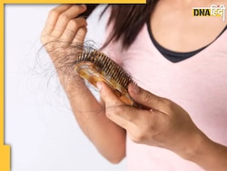 Hair Fall Control: बालों का झड़ना बना देगा गंजा, ये 5 नेचुरल ऑयल रोक सकते हैं हेयर फॉल