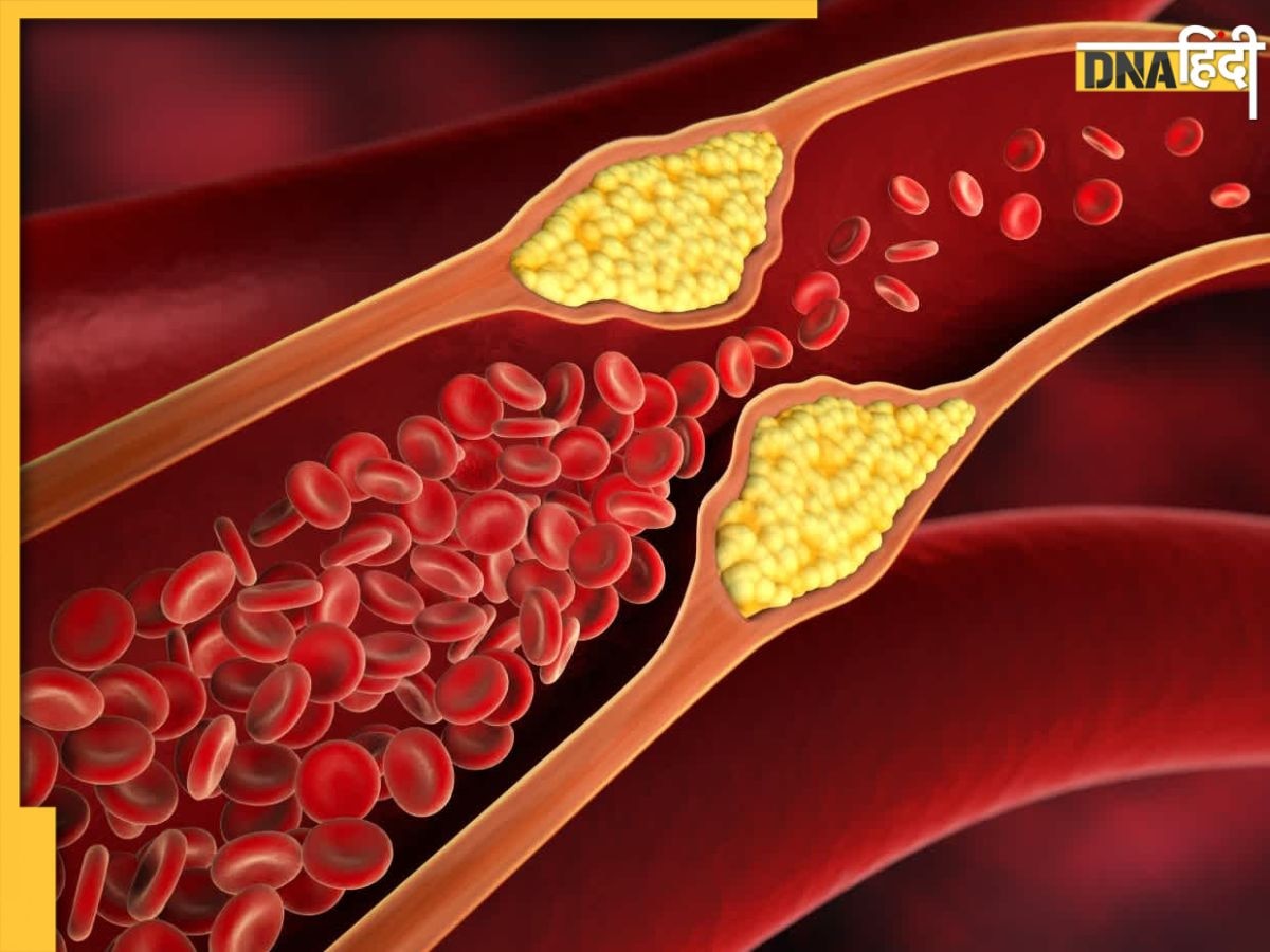 Reduce High Cholesterol: बैड कोलेस्ट्रॉल का काल है ये 5 हरे पत्ते, खाली पेट चबाने से बाहर होगा नसो��ं में जमा गंदा कोलेस्ट्रॉल