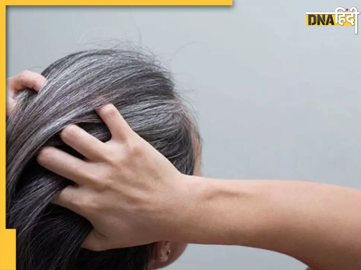 White Hair Remedies: सफेद बालों को काला कर देंगी रसोई में रखी ये 3 चीजें, जान लें इस्तेमाल करने का तरीका