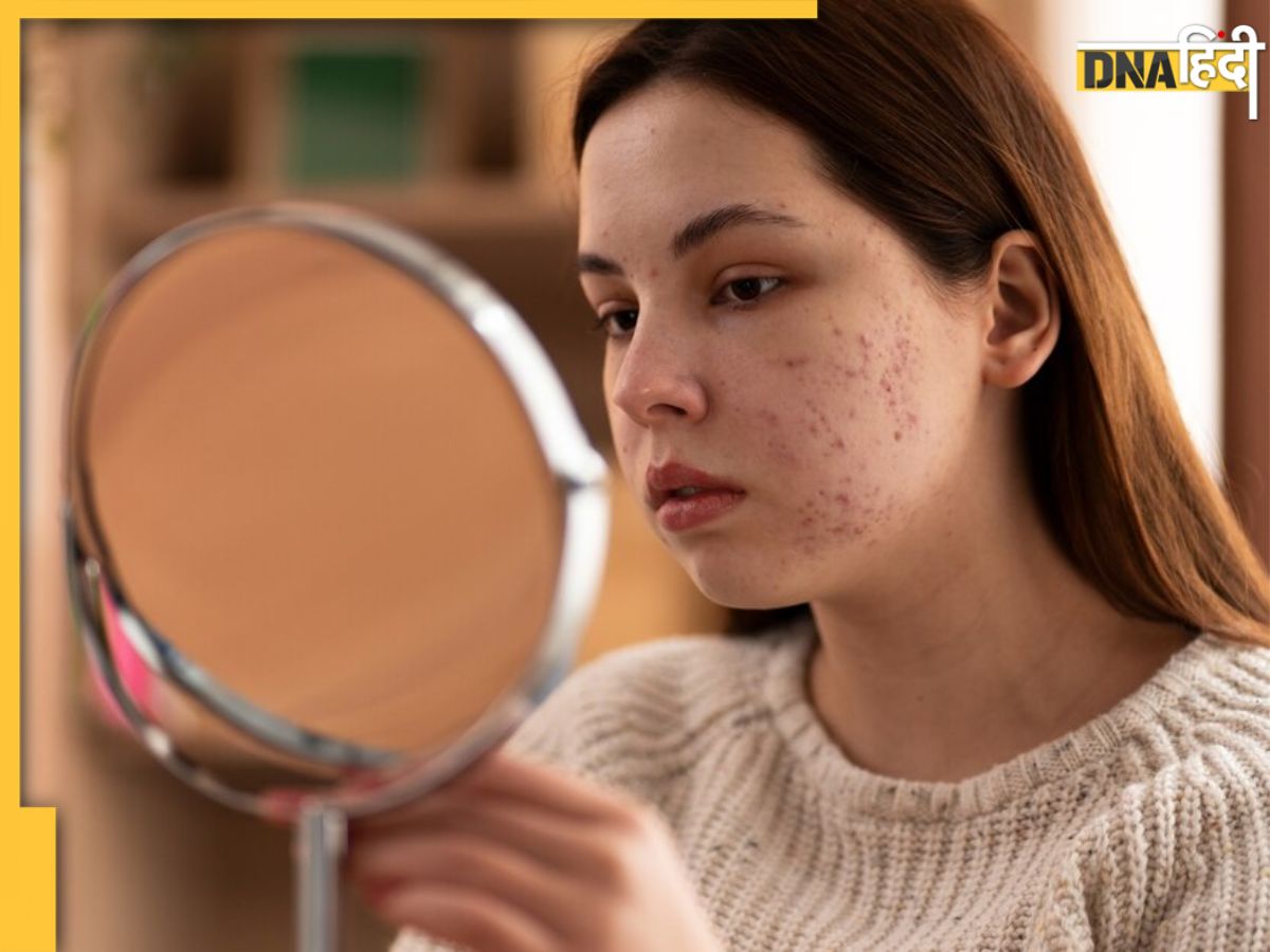 Vitamin C Deficiency शरीर में विटामिन C की कमी से नजर आते हैं ये लक्षण